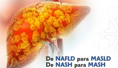 Esteatose Hepática:  Atualização 2025