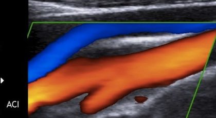 Ultrassonografia com Doppler de baixa a alta complexidade, inclusive pré operatória.